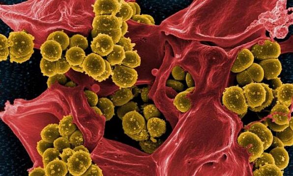 Staphylococcus aureus бактериялык простатиттин себеби болуп саналат