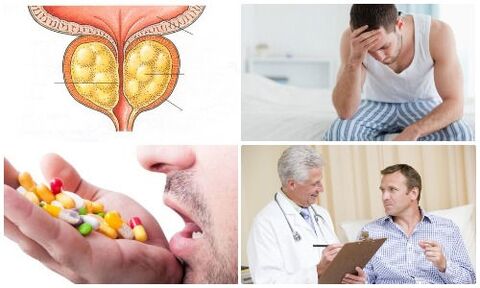 эркектерде простатит
